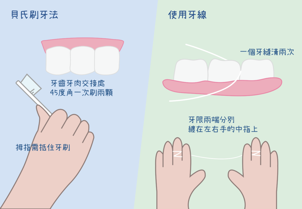 用貝氏刷牙法和牙線清潔口腔