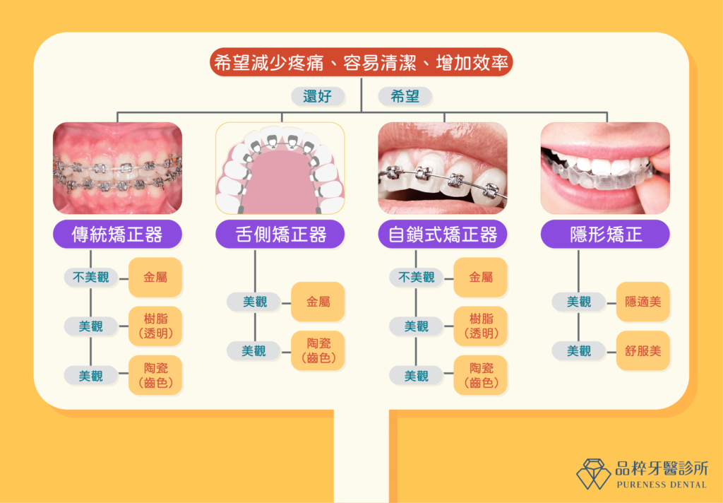四種牙齒矯正器美觀度比較