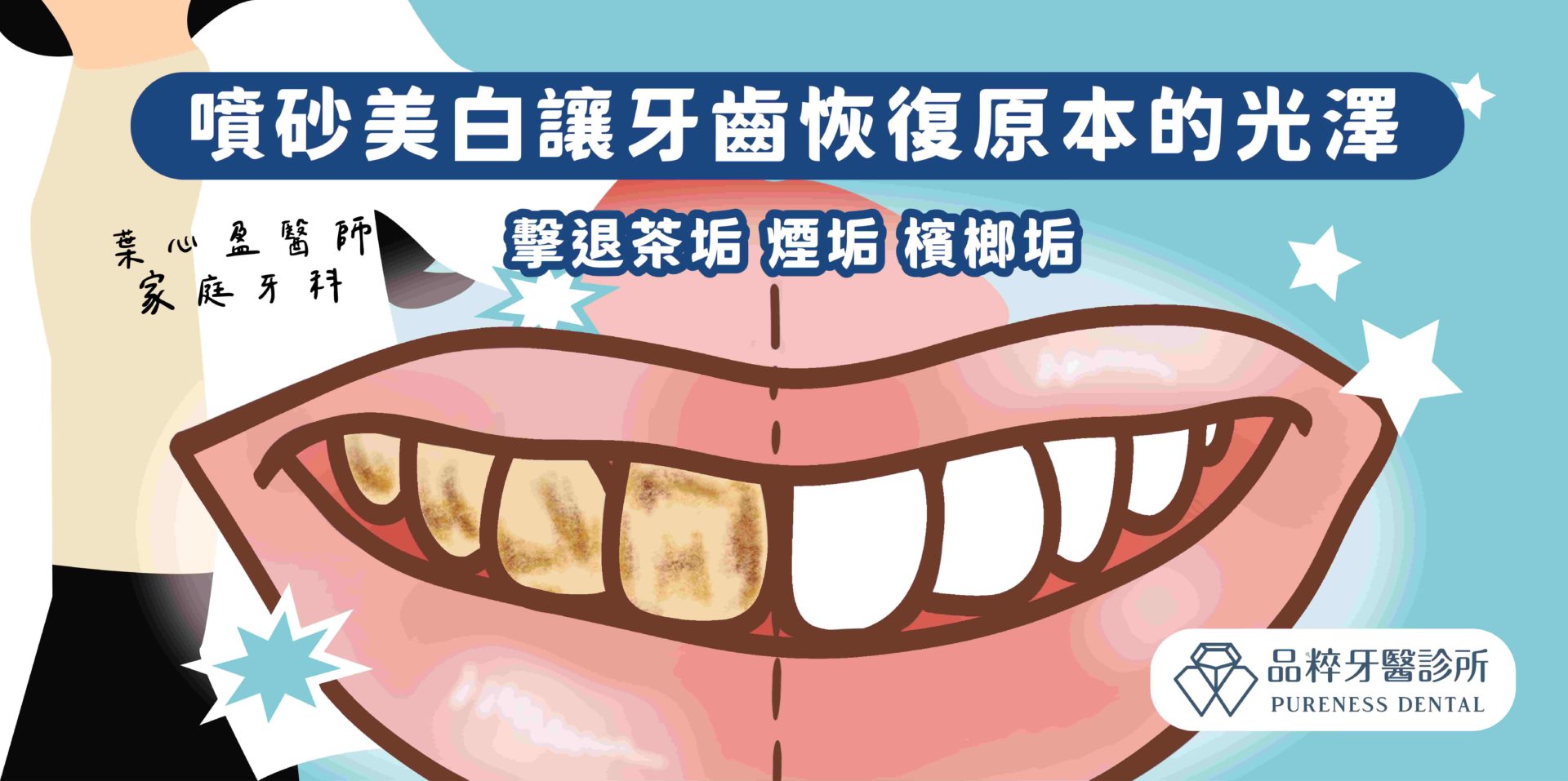 [問題] 牙齒疑似茶垢(竹北) - 看板teeth_salon - PTT網頁版